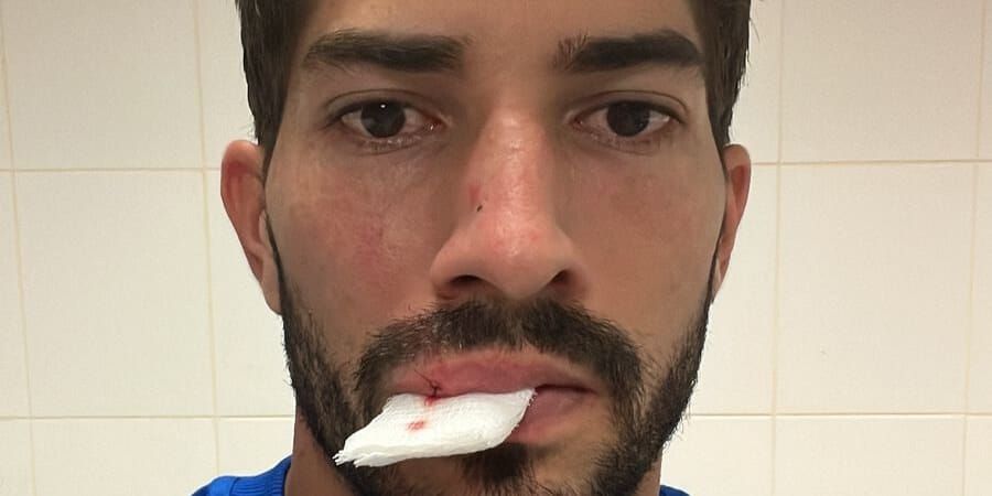 Skandaliczna sytuacja w Brazylii. Lucas Silva uderzony telefonem z trybun Zdjęcie główne wpisu