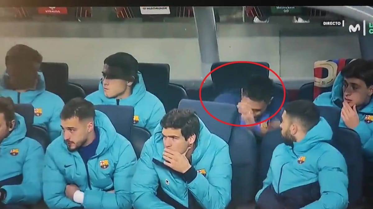 Nietypowy przypadek Raphinhi. Nabawił się urazu, wyładowując swoją złość po zejściu z boiska w meczu z Manchesterem United Zdjęcie główne wpisu