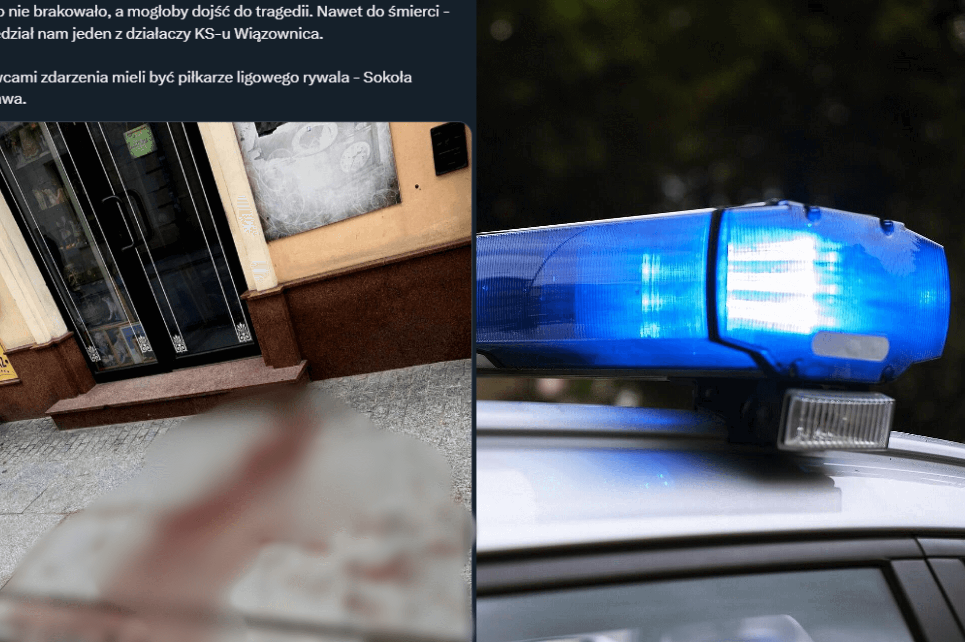 Ogromny skandal. Piłkarz trafił do szpitala po pobiciu przez zawodników innego klubu. „Pojawiła się krew” Zdjęcie główne wpisu