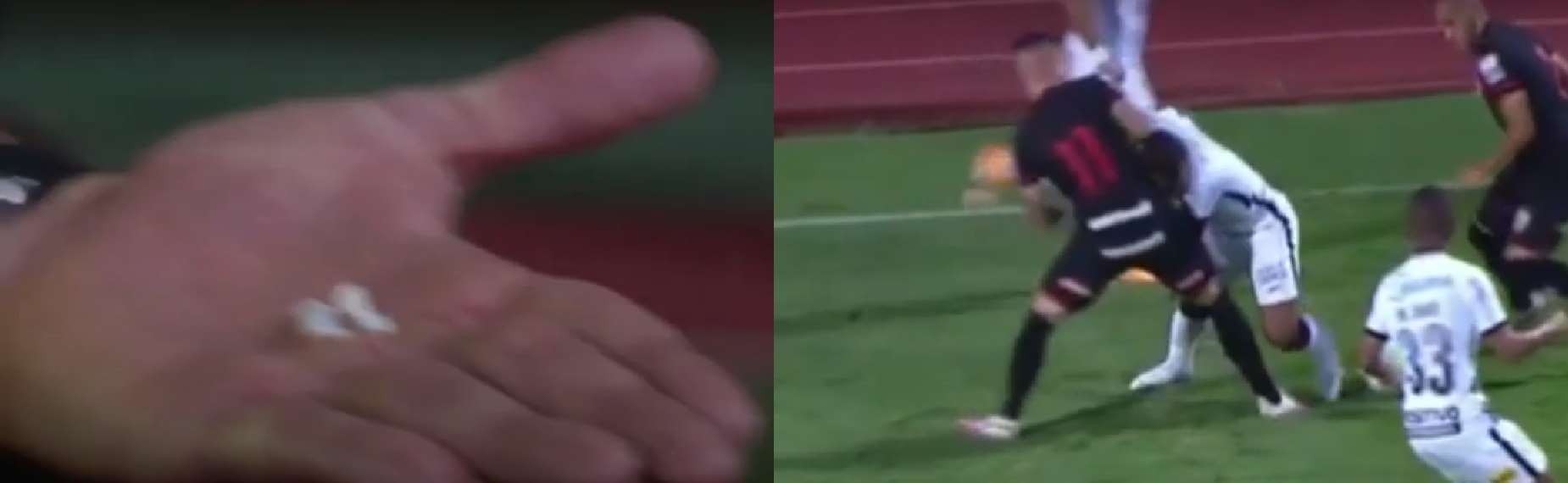 Nietypowa sytuacja w meczu ligi brazylijskiej! Piłkarz stracił cztery zęby [WIDEO] Obraz wpisu