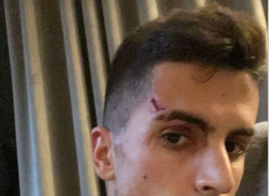 Bandyci zaatakowali Joao Cancelo. „Zranili mnie i chcieli zrobić krzywdę mojej rodzinie” Obraz wpisu