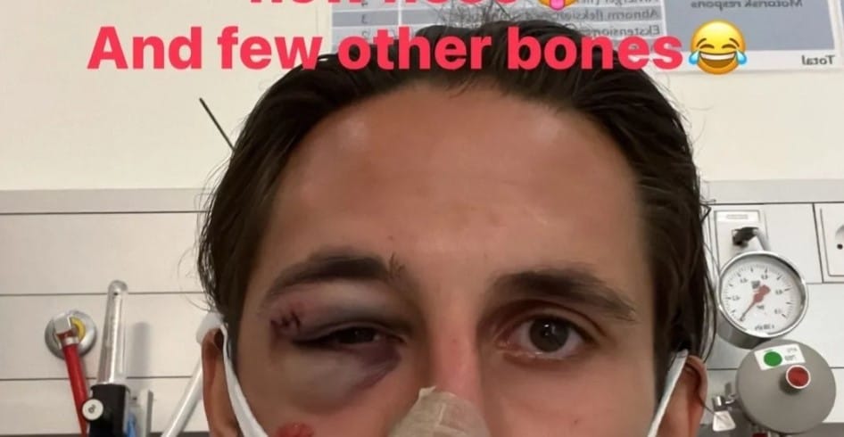 Kamil Grabara pokazał kibicom efekt zderzenia z zawodnikiem Aalborga. „Przez pewien czas nie zobaczycie mnie na boisku” Obraz wpisu