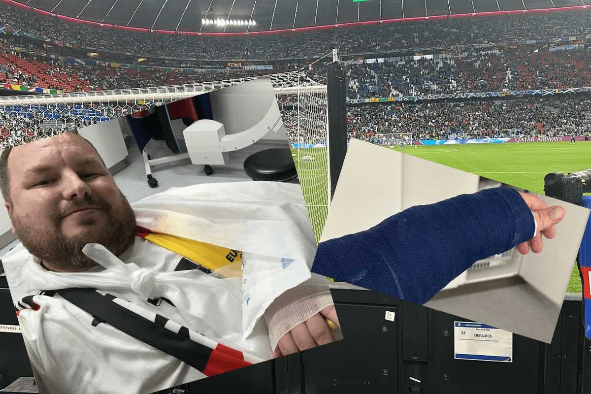 Pech kibica reprezentacji Niemiec. Fuellkrug złamał mu rękę tuż przed rozpoczęciem meczu ze Szkocją Obraz wpisu