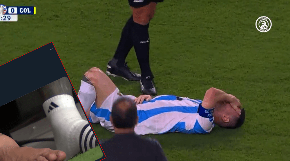 Tak wyglądała noga Messiego po urazie w finale Copa America. Boli od samego patrzenia Obraz wpisu