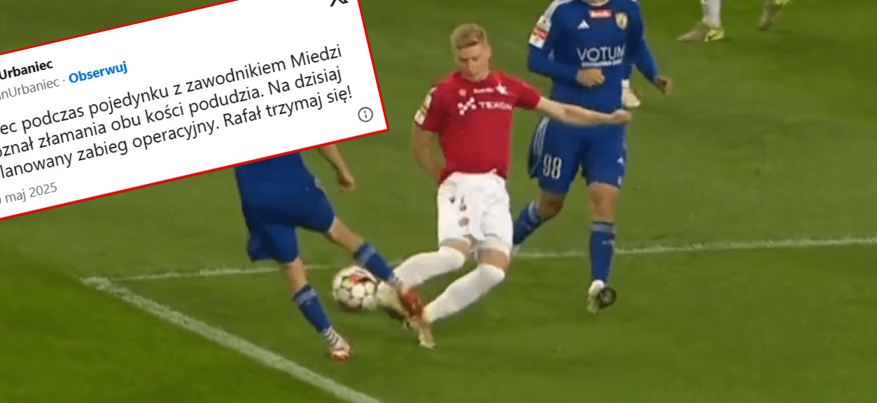 Wiadomo, co ze zdrowiem Rafała Mikulca. Wisła Kraków przekazała fatalne informacje Obraz wpisu